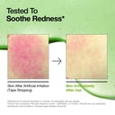 ANUA Azelaic Acid 10% Serum - after and before results