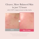 Medicube TXA Niacinamide 15 Serum before and after 72 hours