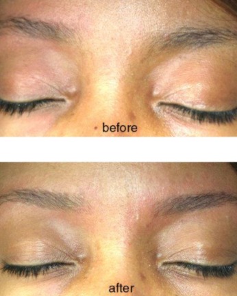 Image of  Brows, Straight, Brow Shaping, Threading, Brow Technique