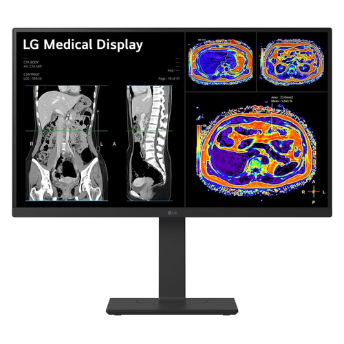 LG Monitor Clínico IPS de 27", 16:9, 8 MP, 4K, HDMI, DP, USB-C, com articulação giratória médica 27HS713C-B - LG 27HS713C-B