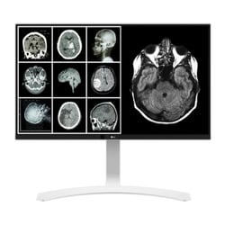 LG MONITOR CLINICO IPS 27" 16:9 8MP 4K HDMI DP MEDICO 27HJ712C-W - LG 27HJ712C-W