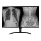 LG Monitor de diagnóstico IPS de 32" (31,5) com 8 MP, UHD 4K, HDMI e DP, com função de rotação – 32HL512D - LG 32HL512D-M