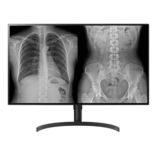 LG Monitor de diagnóstico IPS de 32" (31,5) com 8 MP, UHD 4K, HDMI e DP, com função de rotação – 32HL512D - LG 32HL512D-M