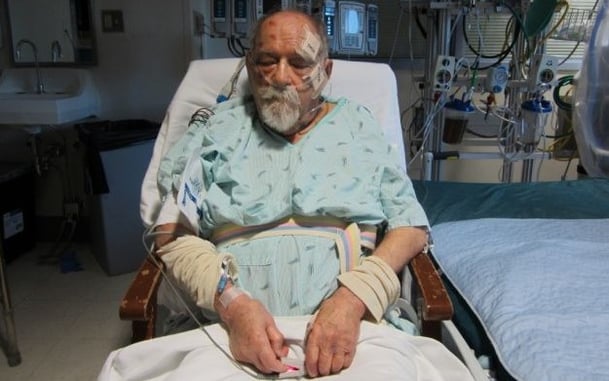 Why Arm Yourself: Repeat Violent Criminal Nearly Kills Elderly Couple During Home Invasion