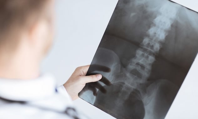 X-ray Technician To Patient: “Your Holster Is Showing, And You Need A New Belt”