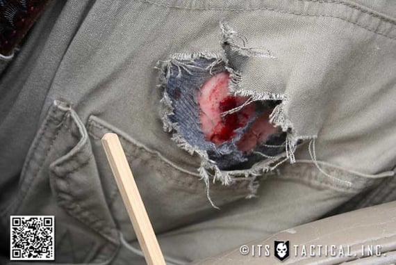 ER Patient Comes In With Gunshot Caused By… Holster? User Error?