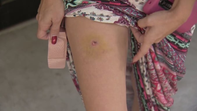 You’re Involved In A Self-Defense Shooting And You’ve Been Shot In The Leg, Are You Prepared Until Help Arrives?