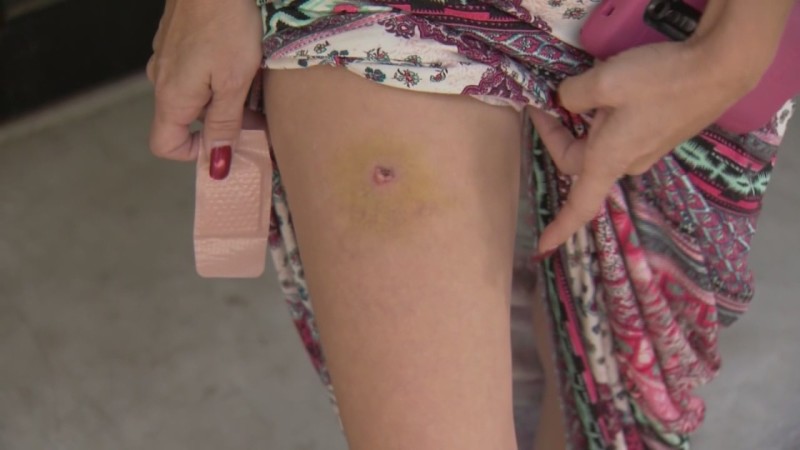 You’re Involved In A Self-Defense Shooting And You’ve Been Shot In The Leg, Are You Prepared Until Help Arrives?