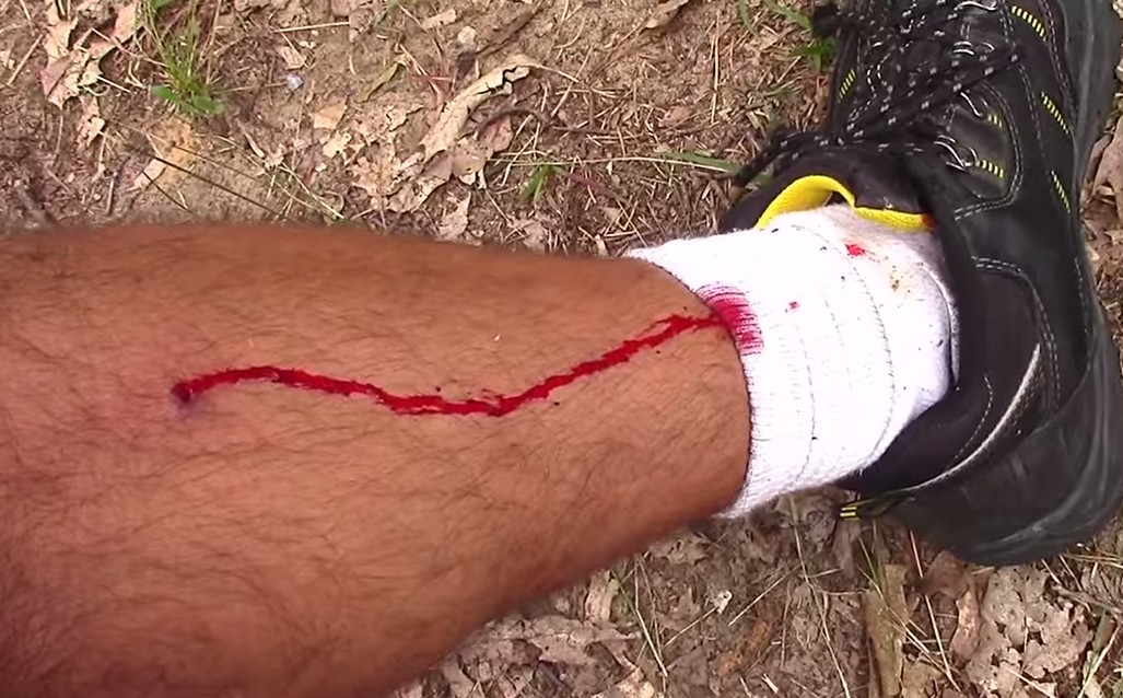 [VIDEO] Why It’s A Good Idea To Have A Med Kit In Your Range Bag