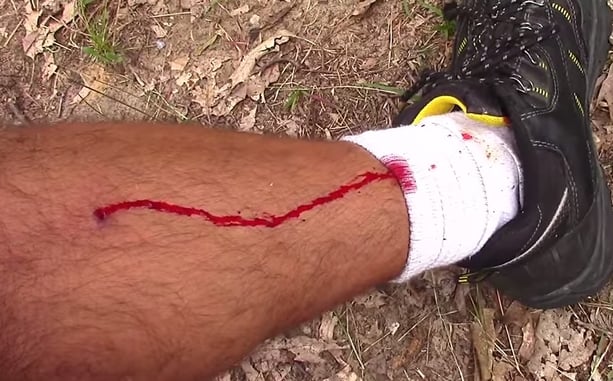 [VIDEO] Why It’s A Good Idea To Have A Med Kit In Your Range Bag