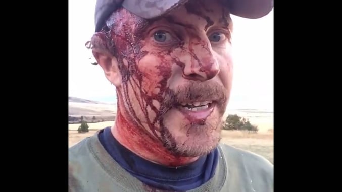 *WARNING: GRAPHIC* Man Attacked By Grizzly Bear, And Why His Pistol Couldn’t Save Him