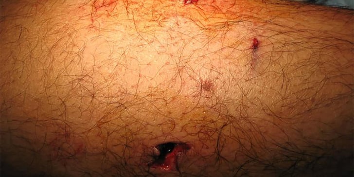 What Bullets Do, And Don’t Do, To The Body On Impact