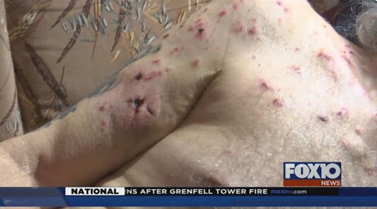 Veteran Takes Hit With Firearm, Shoots Three Intruders And Makes It Out Alive