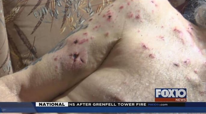 Veteran Takes Hit With Firearm, Shoots Three Intruders And Makes It Out Alive