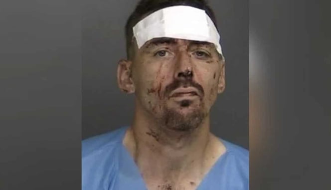 Woman Beats Robbery Suspect Senseless With His Own Shotgun