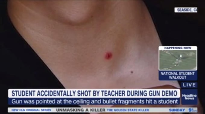 CA Teacher Negligently Discharges Firearm During Safety Lesson And Injures Student