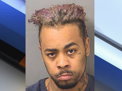 Burglar Who *Really* Doesn’t Know How to Be Sneaky Gains Lovely New Scar