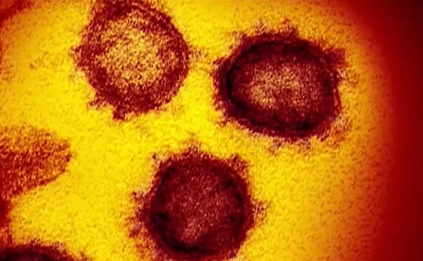 Are You As Prepared For Coronavirus As You Are A Self-defensive Situation?