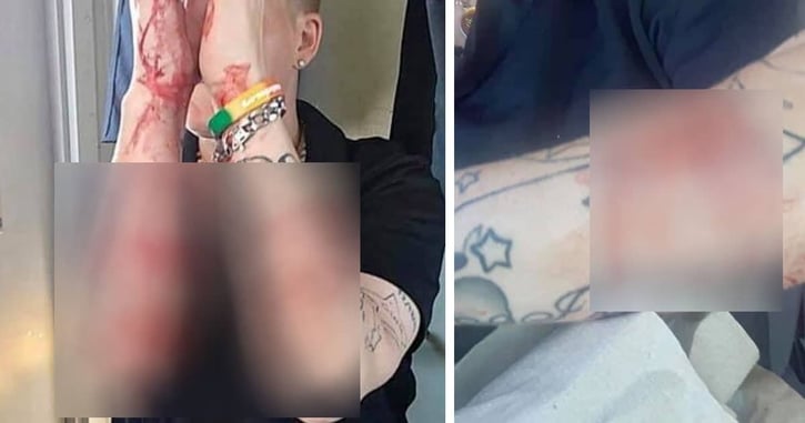 Why We Carry: Guy Slashed With Knife, Apparently Because Of A Mask [Graphic Warning]
