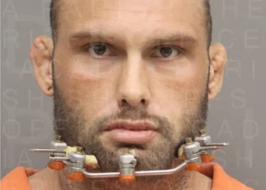 Woman Shoots Man After Allegedly Suffering Months Of Abuse At His Hand