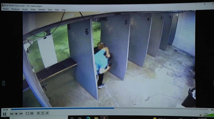 Graphic Warning: Man Shoots Himself In The Face At Range After Hot Brass Goes Down His Shirt