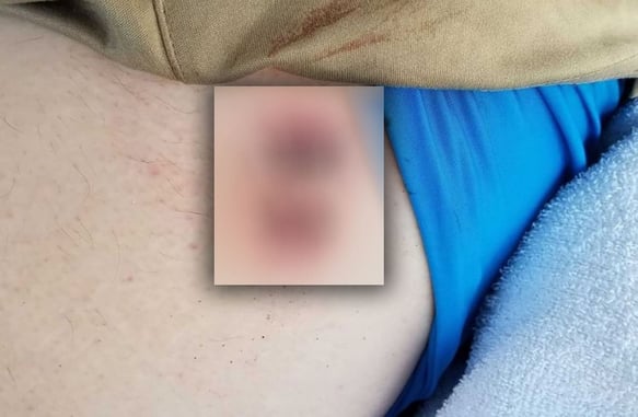 Can Your Holster Kill You? Or At Least Shoot A Hole Through Your Rear End?