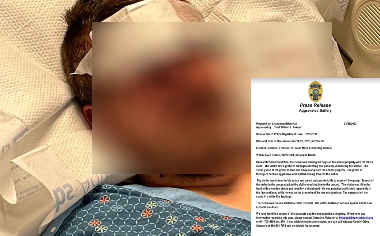 UPDATE: Man Attacked By Teens On Anna Maria Island Pulled Knife On Group As They Approached Him