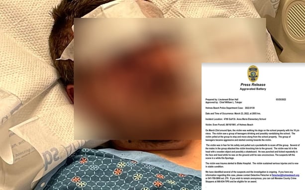 UPDATE: Man Attacked By Teens On Anna Maria Island Pulled Knife On Group As They Approached Him