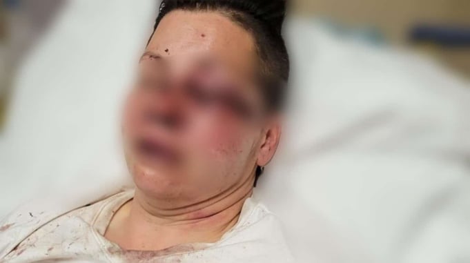 WHY WE CARRY: Woman Attacked, Robbed, And Left Unconscious In Walmart Parking Lot