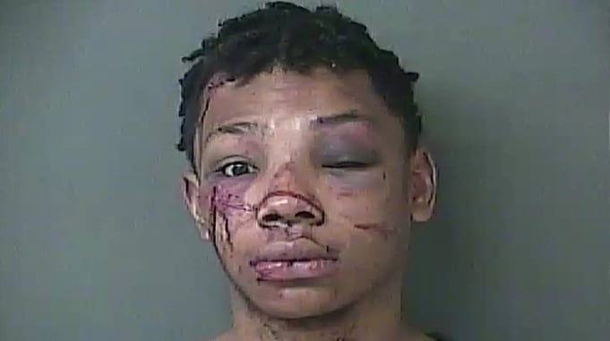 Robber With 2 Guns Disarmed By Armed Apartment Residents