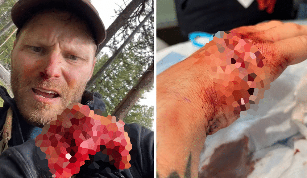 Grizzly bear attack Grand Teton