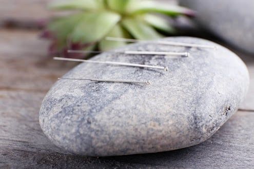 Using Acupuncture for Mood Disorders