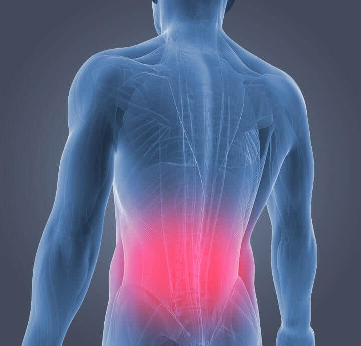Acupuncture and Back Pain | Acupuncture in Milwaukee, WI