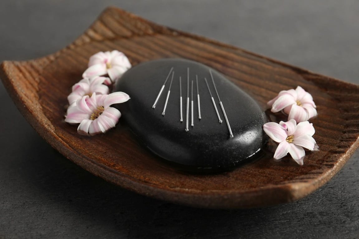 What You Didn’t Know About Acupuncture: FAQs Answered