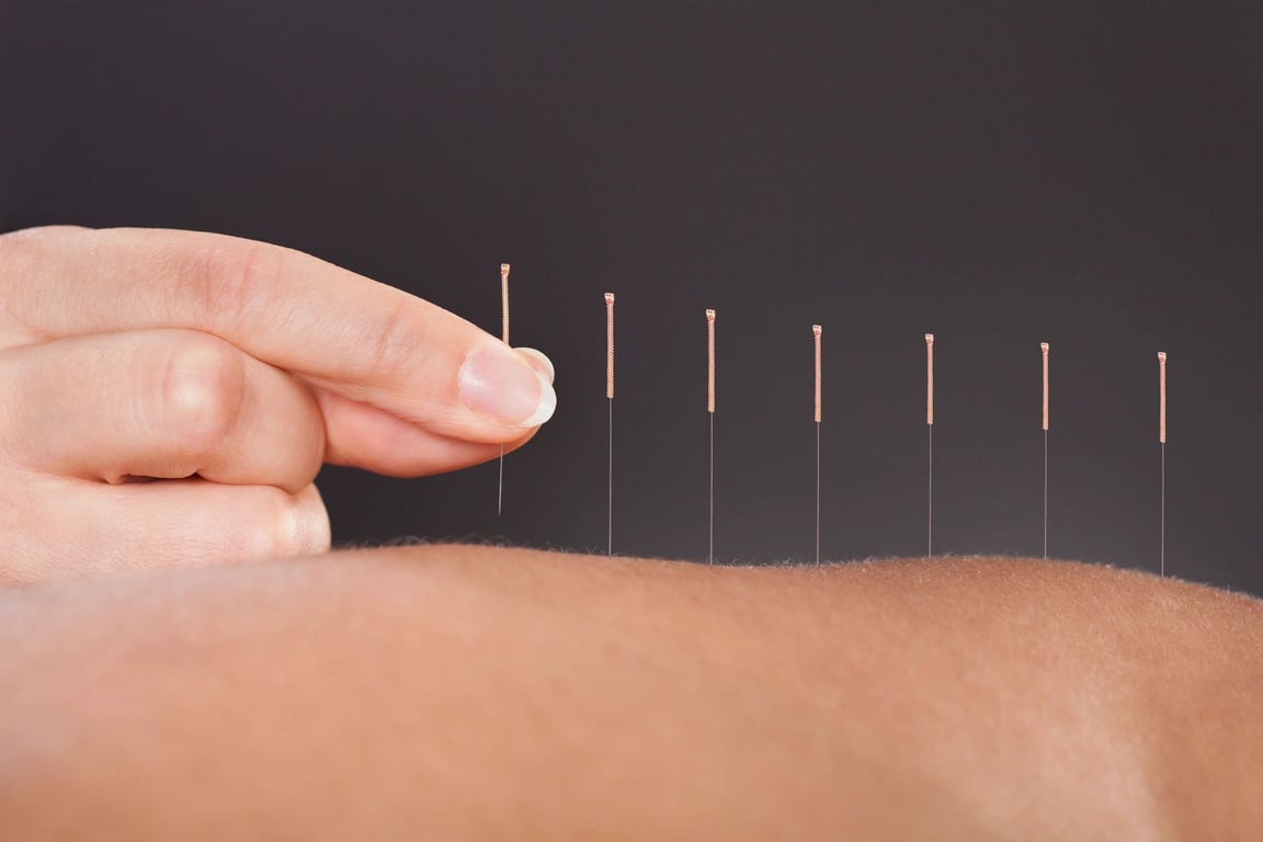 How Does Acupuncture Work? A Beginner’s Guide to Acupuncture in Milwaukee, Wisconsin