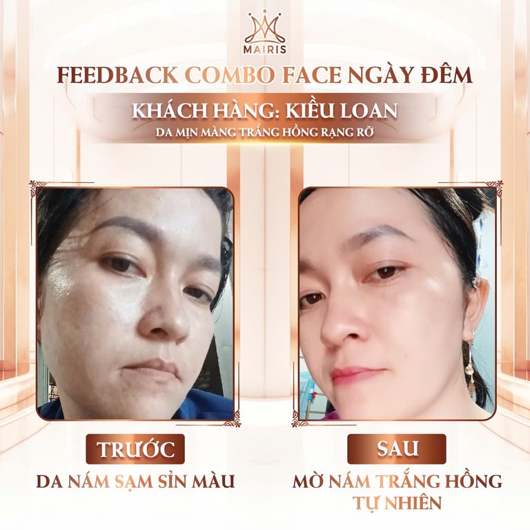 Feedback thật từ khách da nhiễm corticoid sau khi dùng bộ kem ngày - đêm 🌷