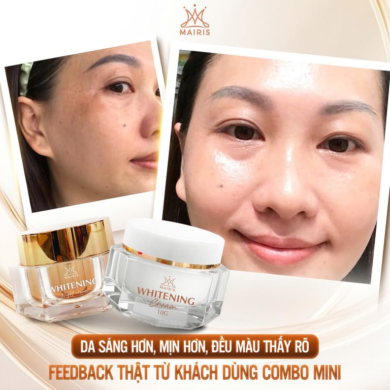 Tạm Biệt Nỗi Ám Ảnh Nám – Da Sáng Lại Từ Ngày Đêm