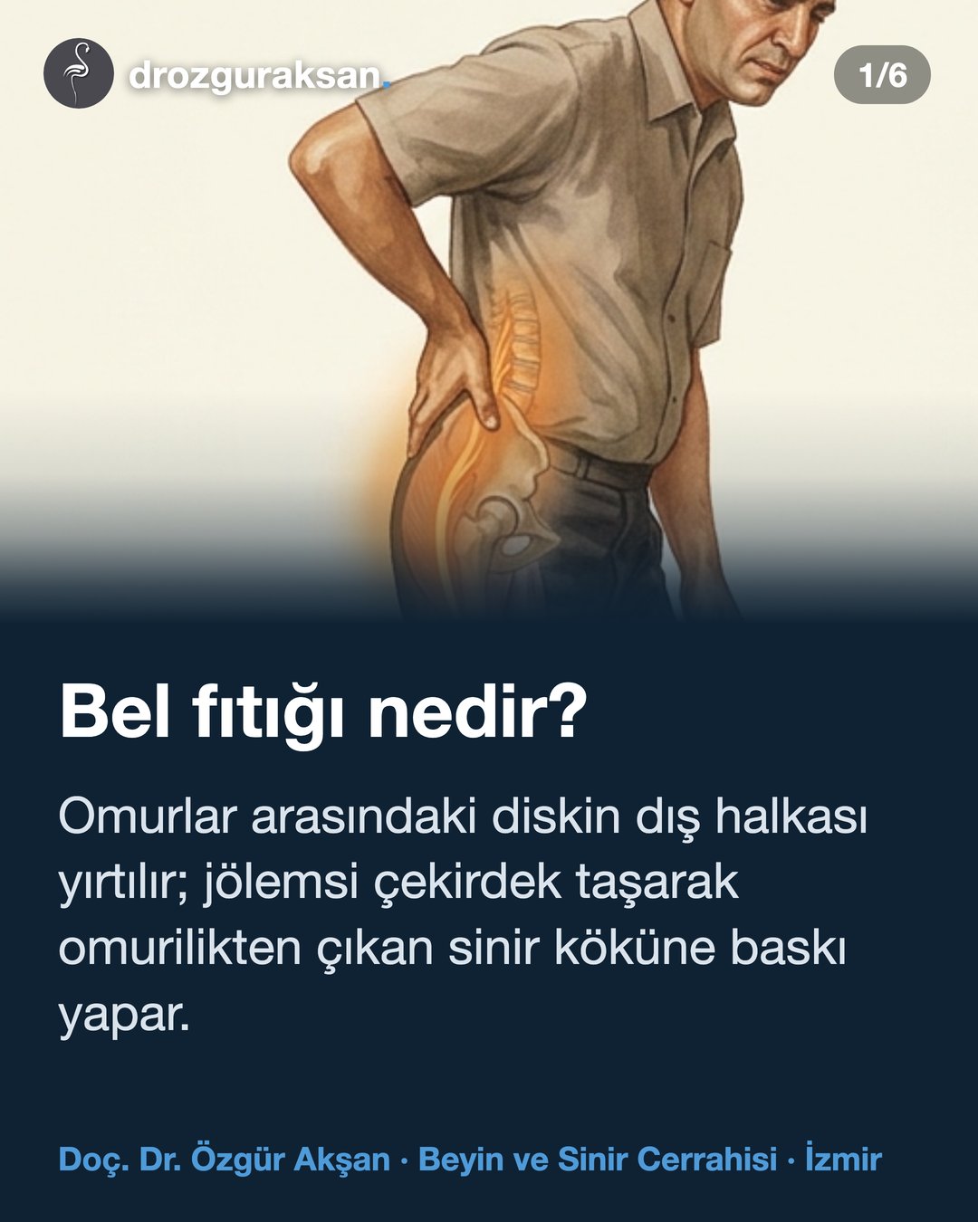 Bel Fıtığı: Belirtiler, Tanı ve Tedavi Yolları — görsel özet kartı 1