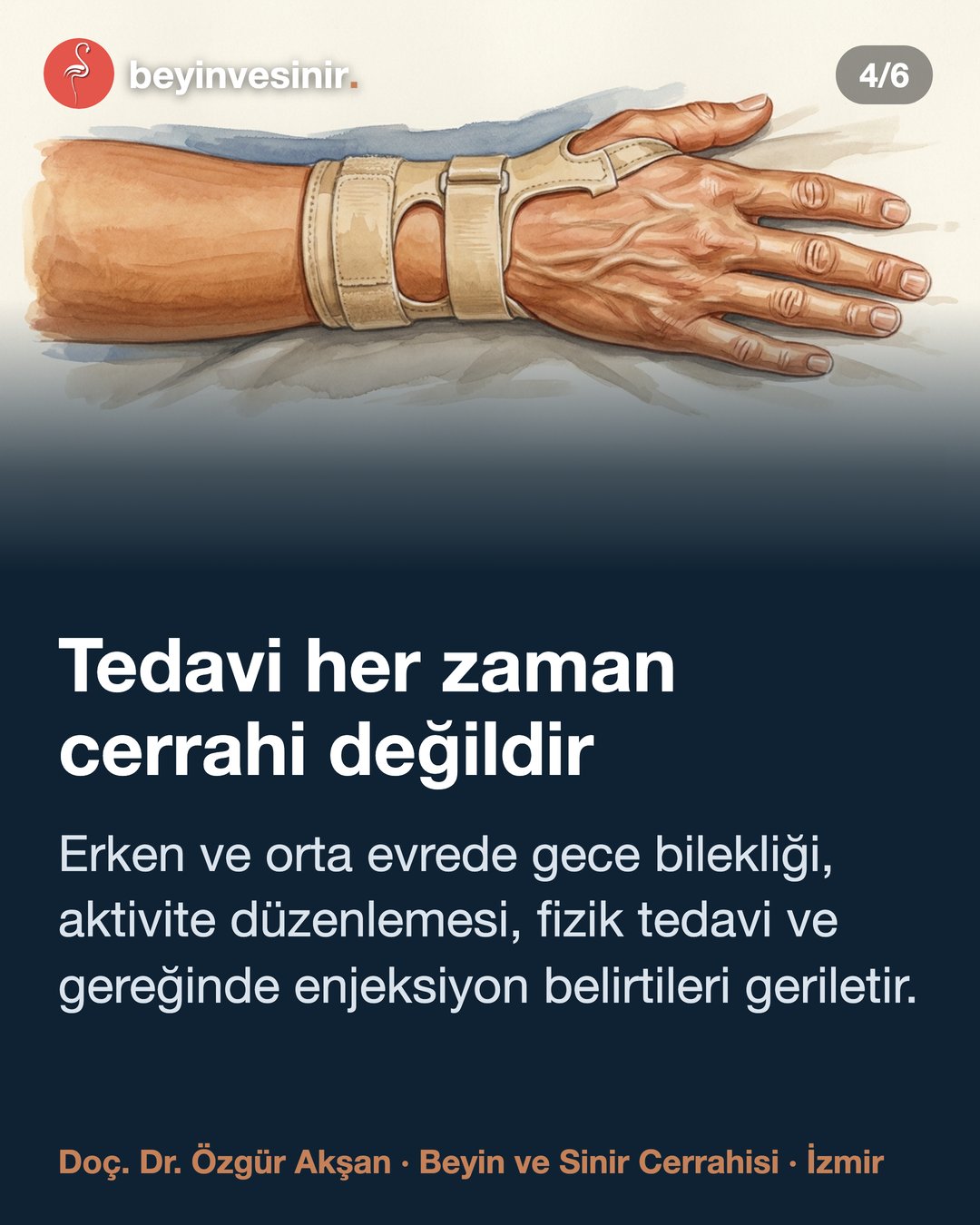 Karpal Tünel Sendromu: El Uyuşması ve Tedavisi — görsel özet kartı 4