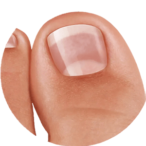 Deutliche Fortschritte