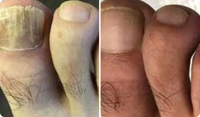 Manfred Braun before after