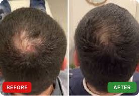 Felix, 27 before after