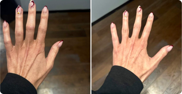 Julia H. before after