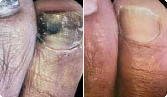 Hannelore Koch before after