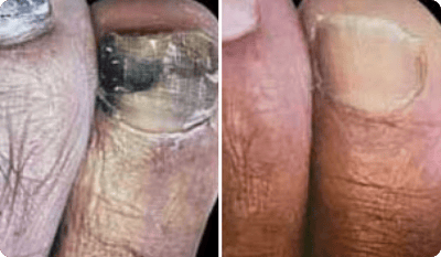 Hannelore Koch Vorher Nachher