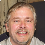 Franz K. before after