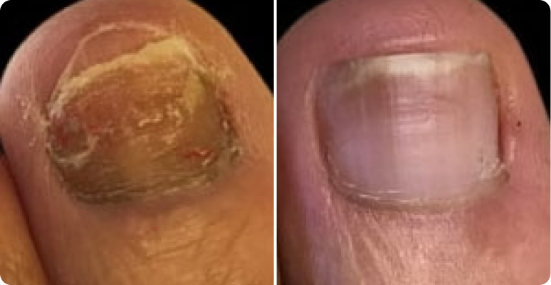 Michael Torres before after