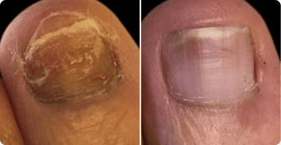 Wolfgang Becker Vorher Nachher