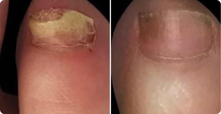 Jennifer Walsh before after