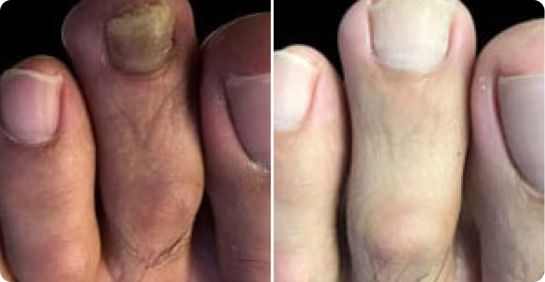 David Thompson before after